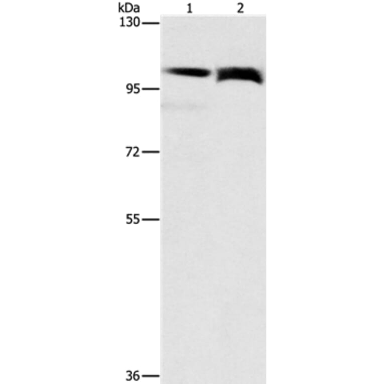 FLT3 Antibody from Signalway Antibody (36143) - Antibodies.com