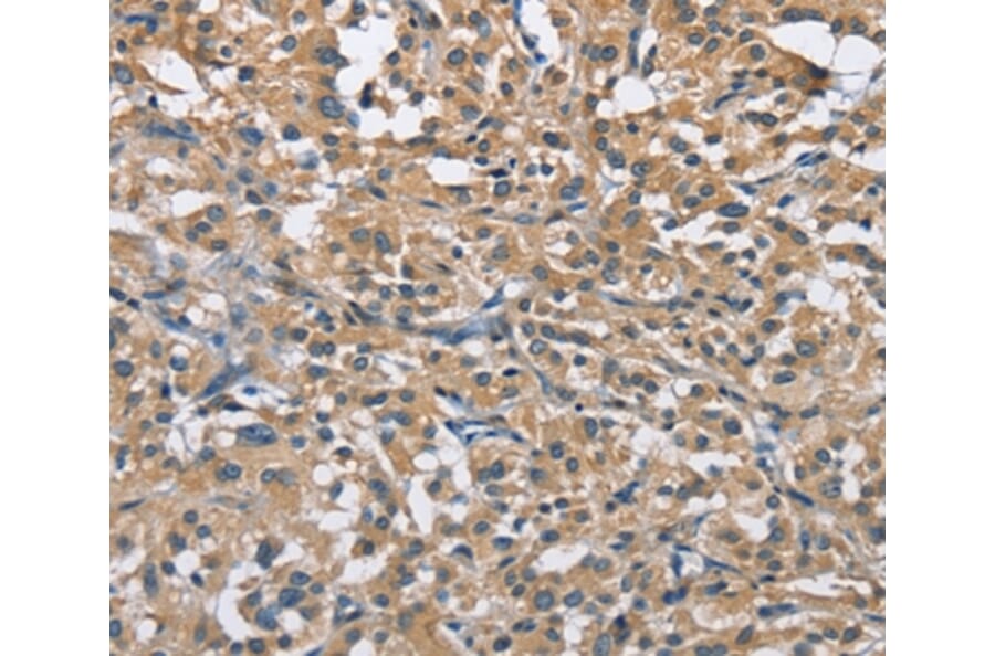 Immunohistochemistry - FLT3 Antibody from Signalway Antibody (36143) - Antibodies.com