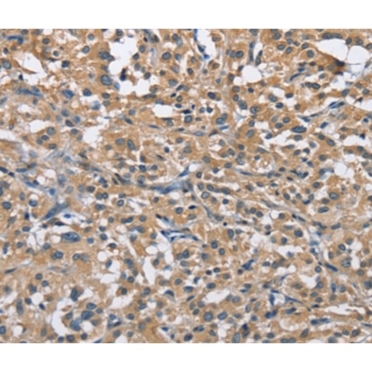 Immunohistochemistry - FLT3 Antibody from Signalway Antibody (36143) - Antibodies.com