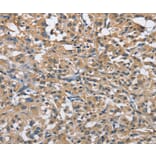 Immunohistochemistry - FLT3 Antibody from Signalway Antibody (36143) - Antibodies.com