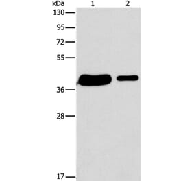 SAE1 Antibody from Signalway Antibody (36160) - Antibodies.com
