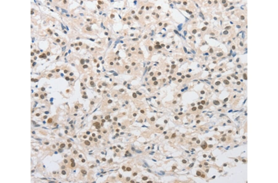 Immunohistochemistry - SAE1 Antibody from Signalway Antibody (36160) - Antibodies.com