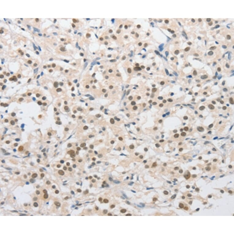 Immunohistochemistry - SAE1 Antibody from Signalway Antibody (36160) - Antibodies.com