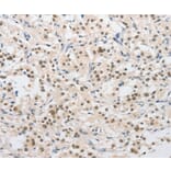 Immunohistochemistry - SAE1 Antibody from Signalway Antibody (36160) - Antibodies.com