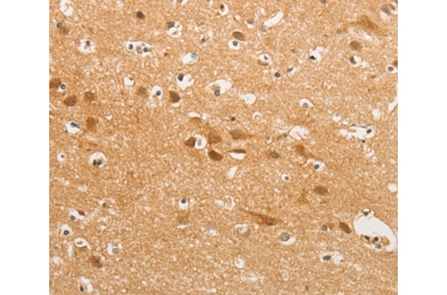 Immunohistochemistry - CDH6 Antibody from Signalway Antibody (36162) - Antibodies.com
