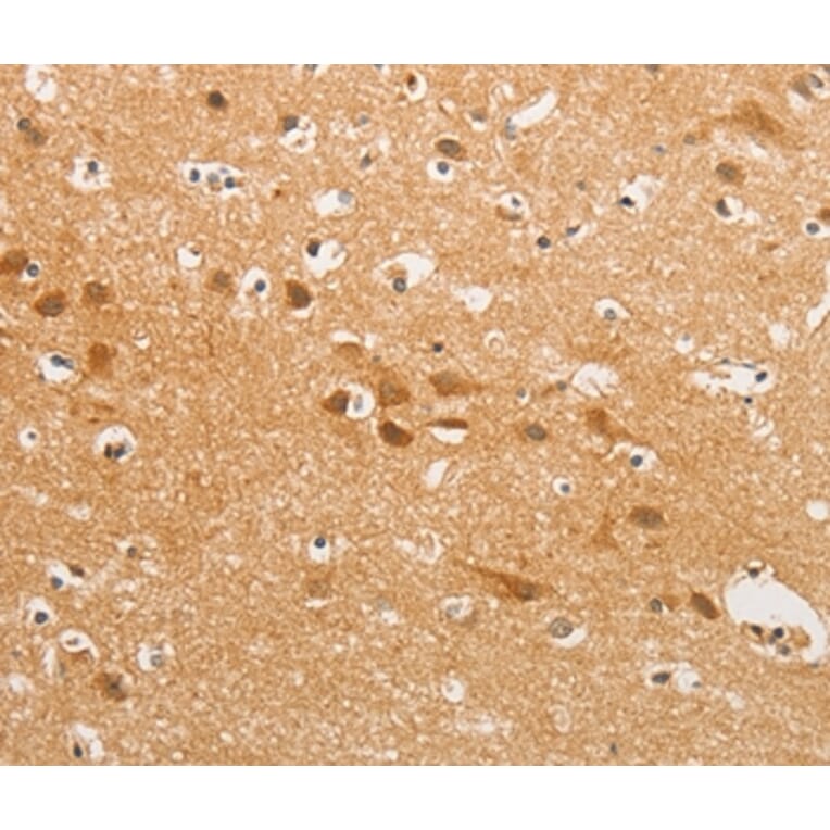 Immunohistochemistry - CDH6 Antibody from Signalway Antibody (36162) - Antibodies.com