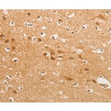 Immunohistochemistry - CDH6 Antibody from Signalway Antibody (36162) - Antibodies.com