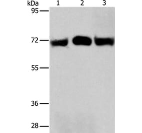RPN1 Antibody from Signalway Antibody (36173) - Antibodies.com