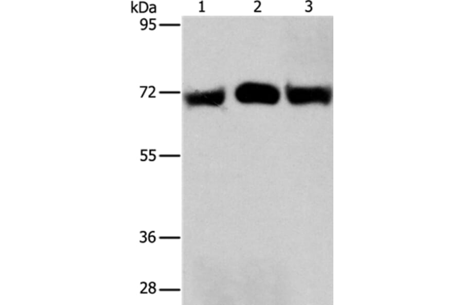 RPN1 Antibody from Signalway Antibody (36173) - Antibodies.com