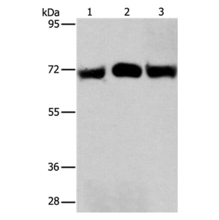RPN1 Antibody from Signalway Antibody (36173) - Antibodies.com
