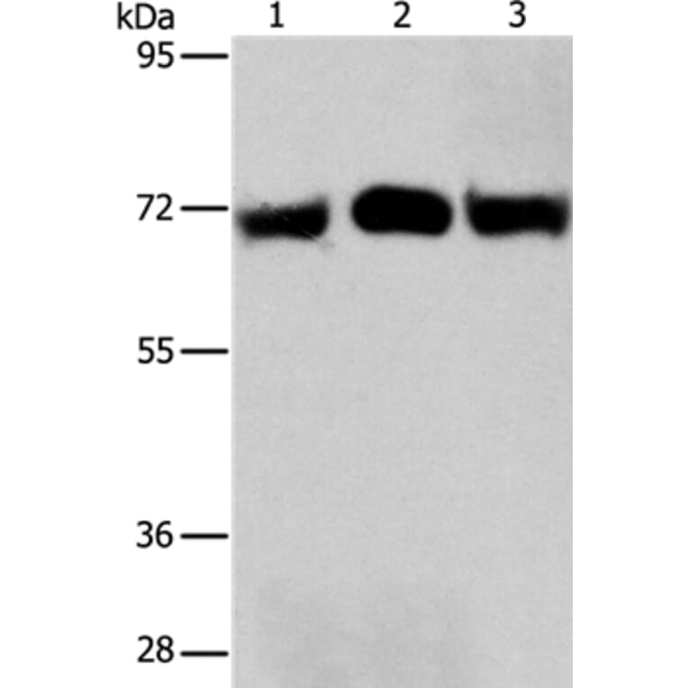 RPN1 Antibody from Signalway Antibody (36173) - Antibodies.com