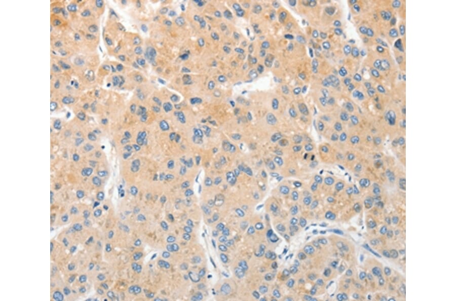 Immunohistochemistry - RPN1 Antibody from Signalway Antibody (36173) - Antibodies.com