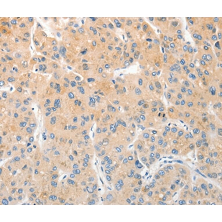 Immunohistochemistry - RPN1 Antibody from Signalway Antibody (36173) - Antibodies.com