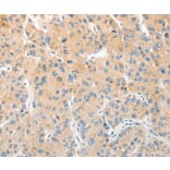 Immunohistochemistry - RPN1 Antibody from Signalway Antibody (36173) - Antibodies.com