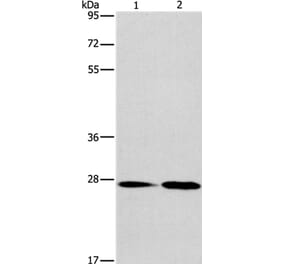 NAT8 Antibody from Signalway Antibody (36180) - Antibodies.com