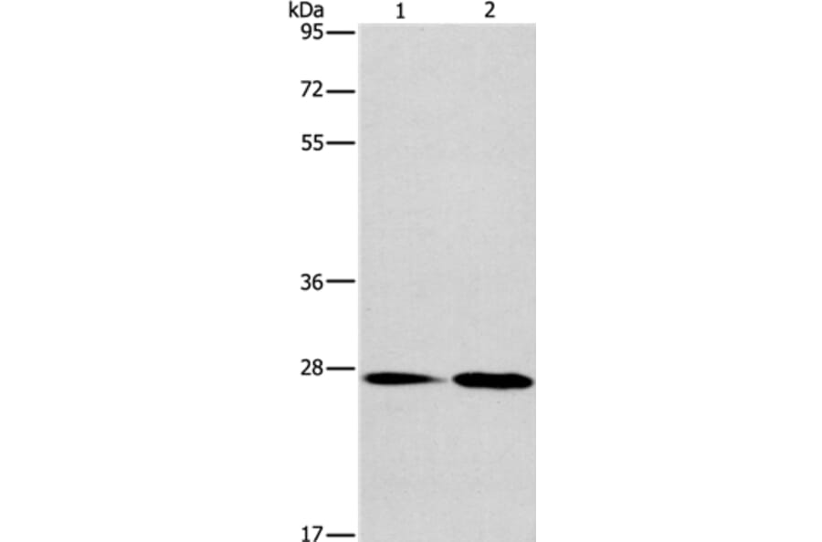 NAT8 Antibody from Signalway Antibody (36180) - Antibodies.com