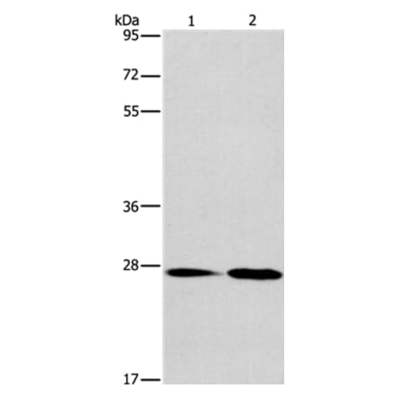 NAT8 Antibody from Signalway Antibody (36180) - Antibodies.com