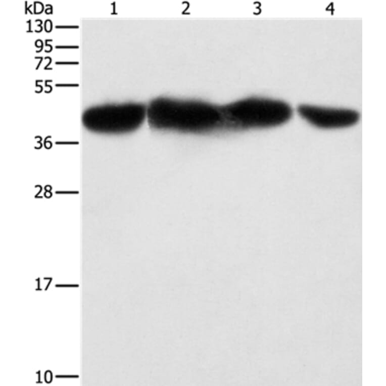PGK2 Antibody from Signalway Antibody (36193) - Antibodies.com