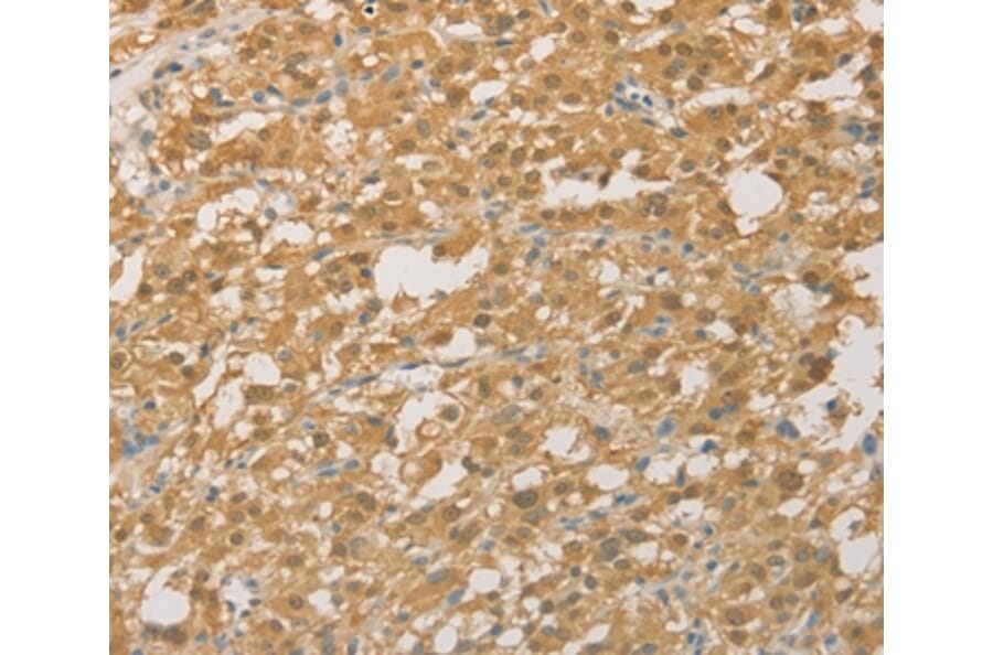 Immunohistochemistry - PGK2 Antibody from Signalway Antibody (36193) - Antibodies.com