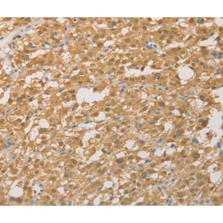 Immunohistochemistry - PGK2 Antibody from Signalway Antibody (36193) - Antibodies.com