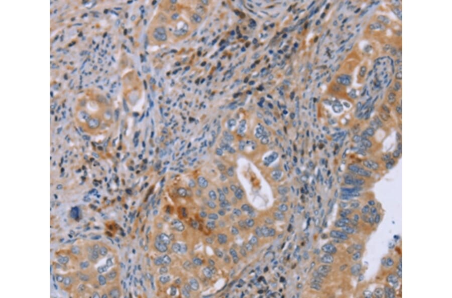 Immunohistochemistry - GMFG Antibody from Signalway Antibody (36200) - Antibodies.com