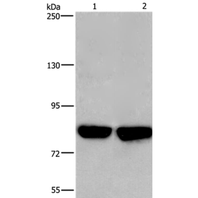 PFKP Antibody from Signalway Antibody (36211) - Antibodies.com