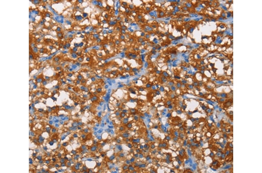 Immunohistochemistry - PFKP Antibody from Signalway Antibody (36211) - Antibodies.com