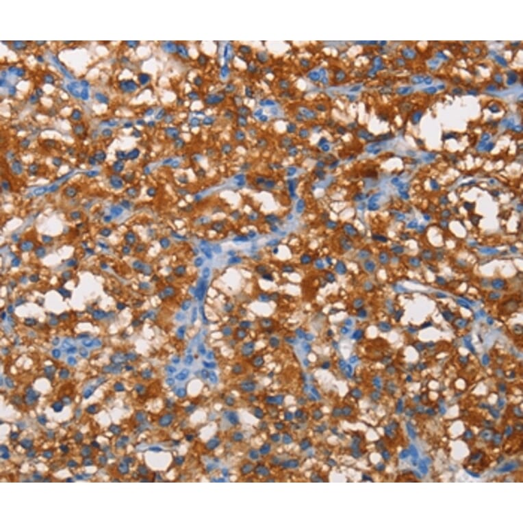 Immunohistochemistry - PFKP Antibody from Signalway Antibody (36211) - Antibodies.com