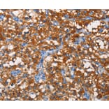 Immunohistochemistry - PFKP Antibody from Signalway Antibody (36211) - Antibodies.com