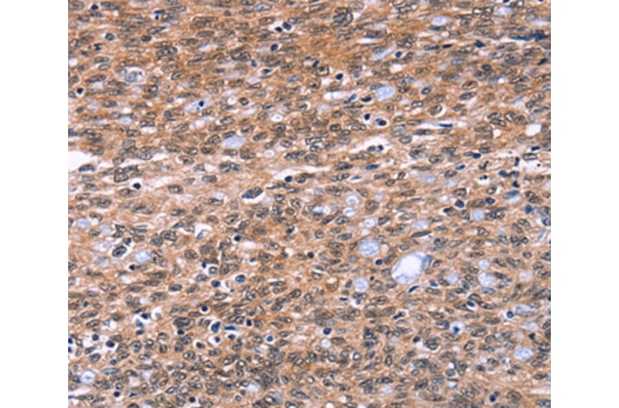 Immunohistochemistry - BAP1 Antibody from Signalway Antibody (36226) - Antibodies.com