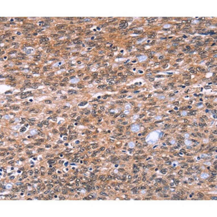 Immunohistochemistry - BAP1 Antibody from Signalway Antibody (36226) - Antibodies.com