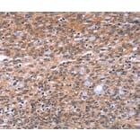 Immunohistochemistry - BAP1 Antibody from Signalway Antibody (36226) - Antibodies.com