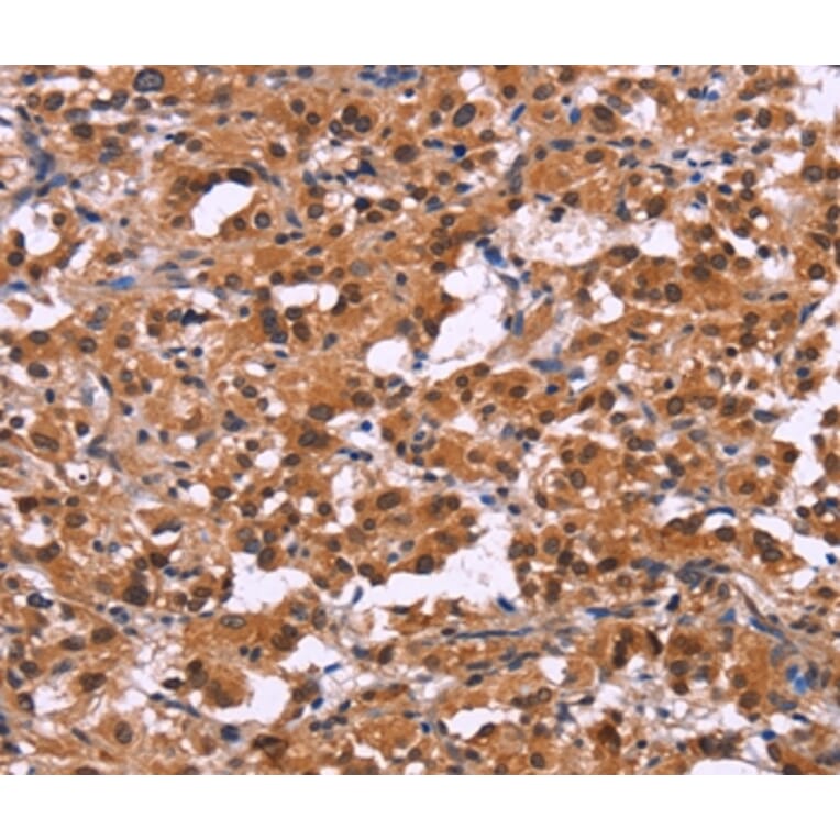 Immunohistochemistry - XPO1 Antibody from Signalway Antibody (36228) - Antibodies.com