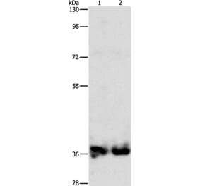 ASPA Antibody from Signalway Antibody (36246) - Antibodies.com