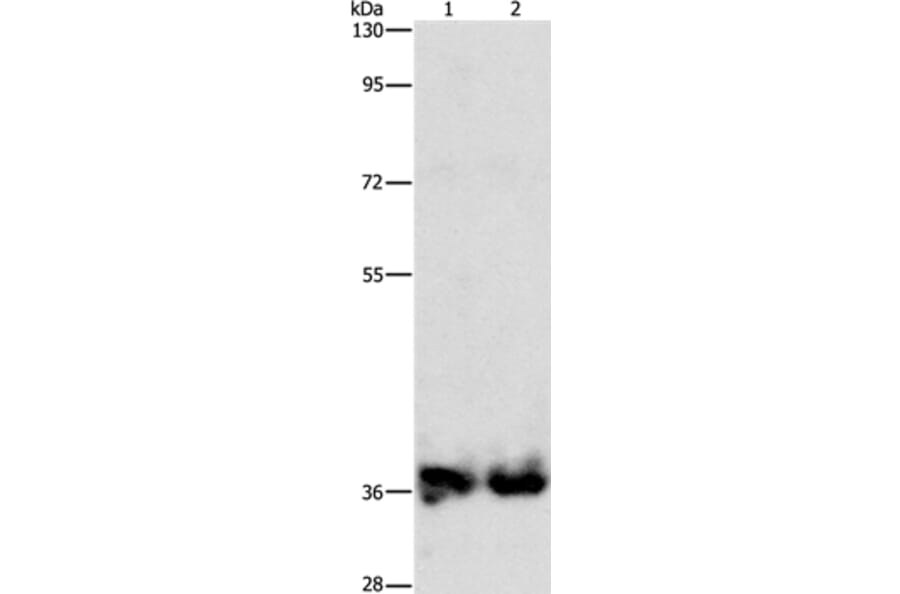 ASPA Antibody from Signalway Antibody (36246) - Antibodies.com