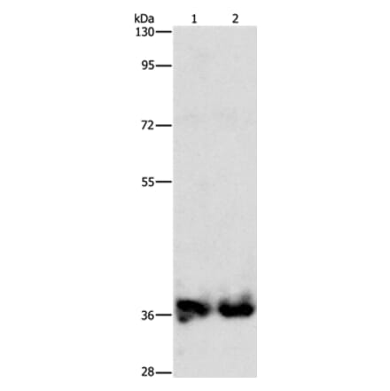 ASPA Antibody from Signalway Antibody (36246) - Antibodies.com