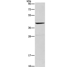 ORM2 Antibody from Signalway Antibody (36251) - Antibodies.com