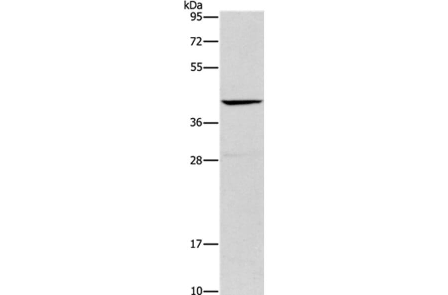 ORM2 Antibody from Signalway Antibody (36251) - Antibodies.com