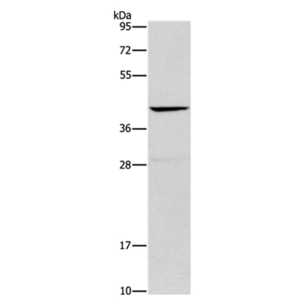 ORM2 Antibody from Signalway Antibody (36251) - Antibodies.com