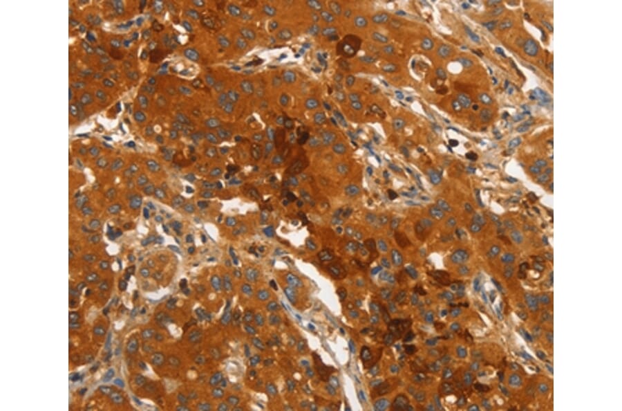 Immunohistochemistry - ORM2 Antibody from Signalway Antibody (36251) - Antibodies.com