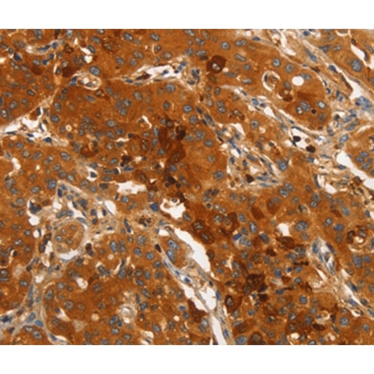 Immunohistochemistry - ORM2 Antibody from Signalway Antibody (36251) - Antibodies.com
