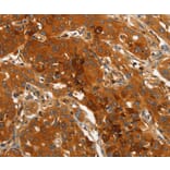 Immunohistochemistry - ORM2 Antibody from Signalway Antibody (36251) - Antibodies.com