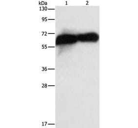 ALPP Antibody from Signalway Antibody (36256) - Antibodies.com