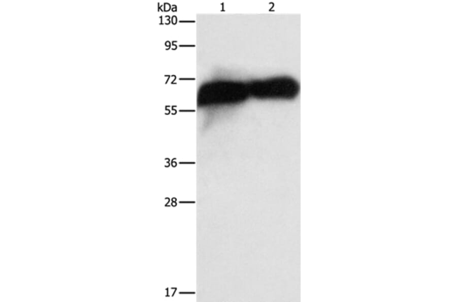 ALPP Antibody from Signalway Antibody (36256) - Antibodies.com