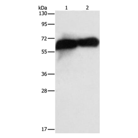 ALPP Antibody from Signalway Antibody (36256) - Antibodies.com