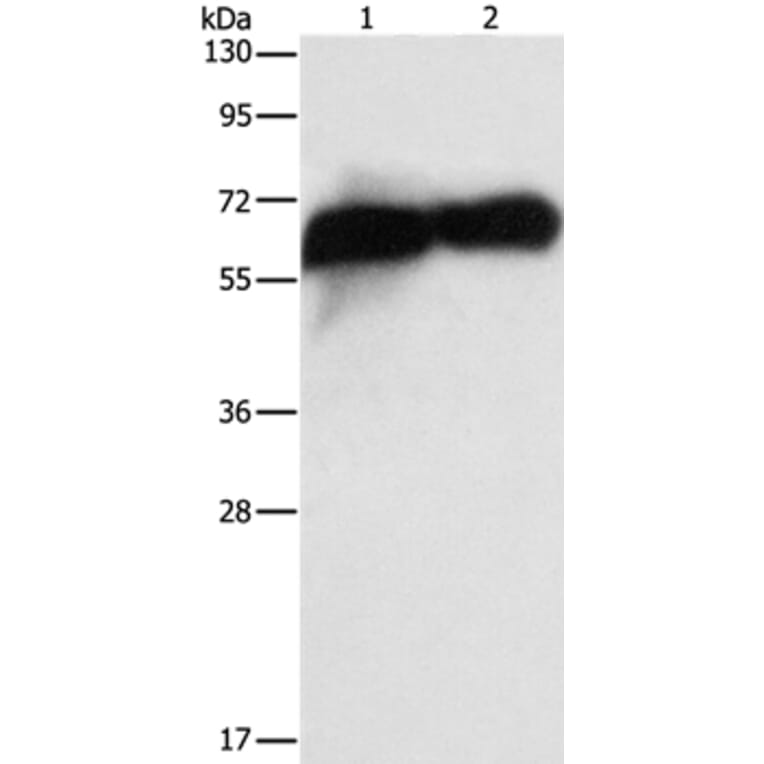 ALPP Antibody from Signalway Antibody (36256) - Antibodies.com