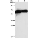 ALPP Antibody from Signalway Antibody (36256) - Antibodies.com