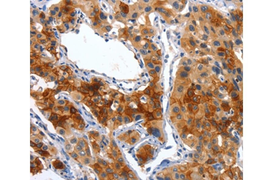 Immunohistochemistry - ALPP Antibody from Signalway Antibody (36256) - Antibodies.com