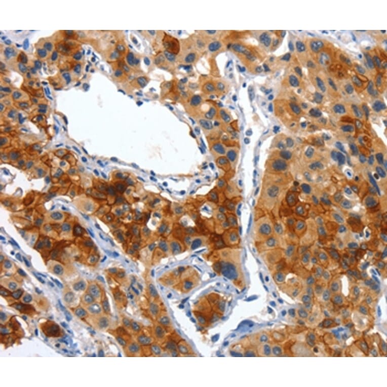 Immunohistochemistry - ALPP Antibody from Signalway Antibody (36256) - Antibodies.com