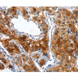Immunohistochemistry - ALPP Antibody from Signalway Antibody (36256) - Antibodies.com
